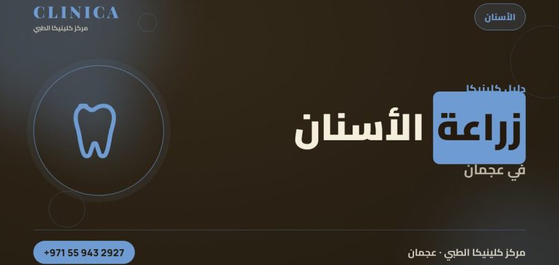 زراعة الأسنان في عجمان – مركز كلينيكا الطبي