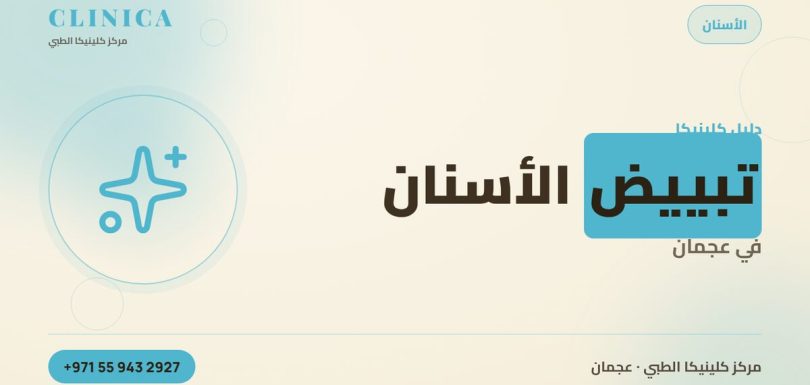 تبييض الأسنان في عجمان – مركز كلينيكا الطبي